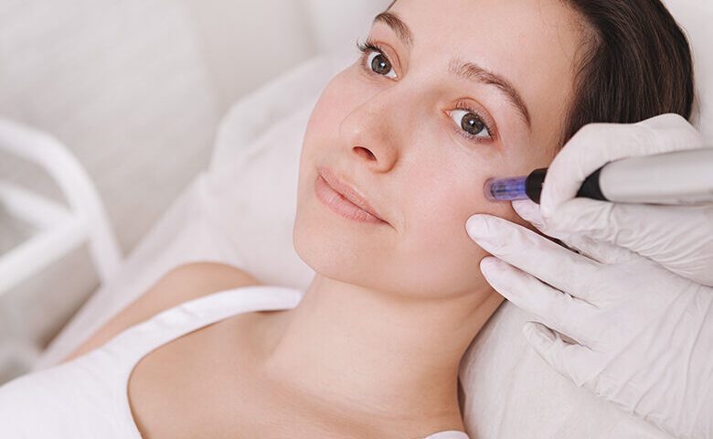 Bioestimulação de Colágeno