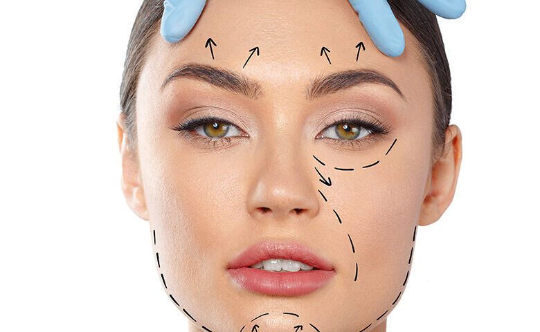 Ultrassom microfocado